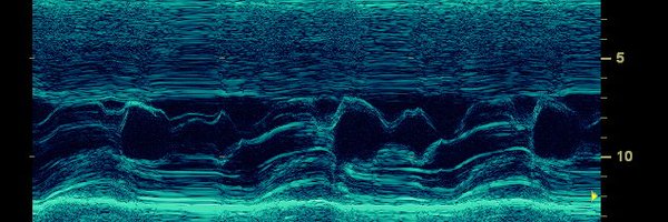 on_imaging Profile Banner