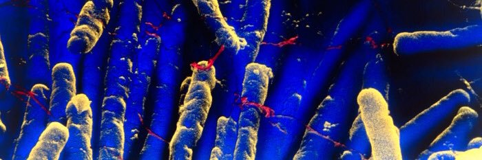 MSK Infectious Diseases Advanced Topics Lectures banner