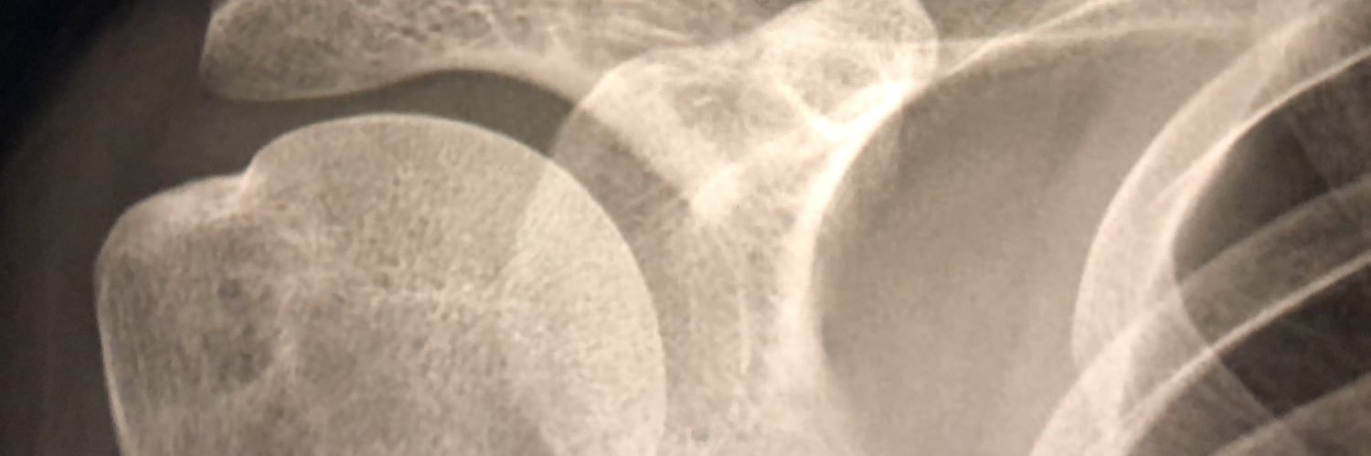 Mexican Ortho banner