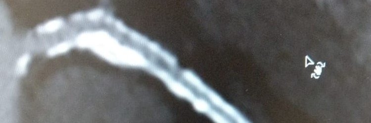Pulse20198118's profile banner image