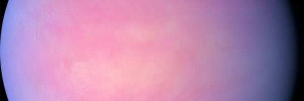 lars banner