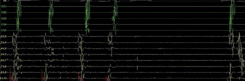 Stefan Simović banner