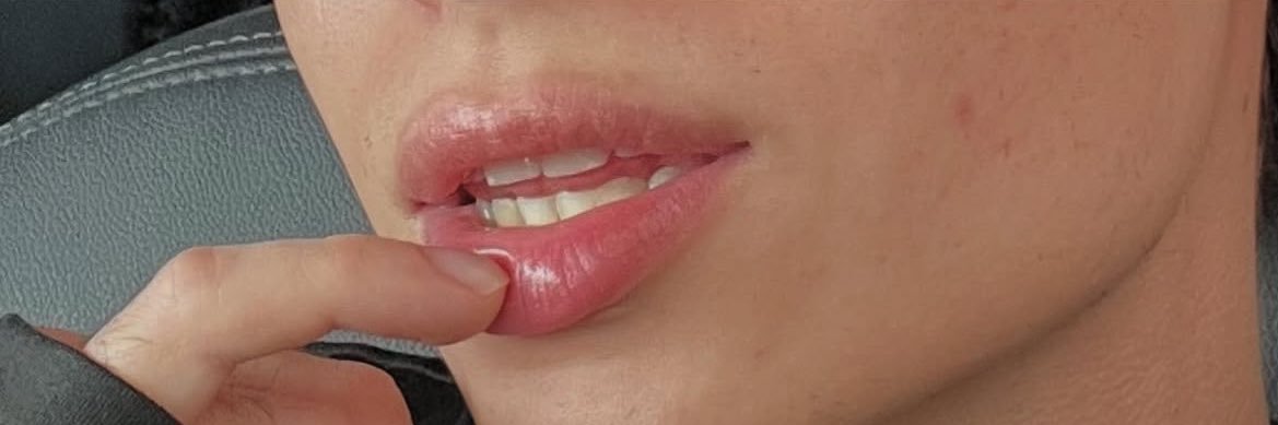 w banner
