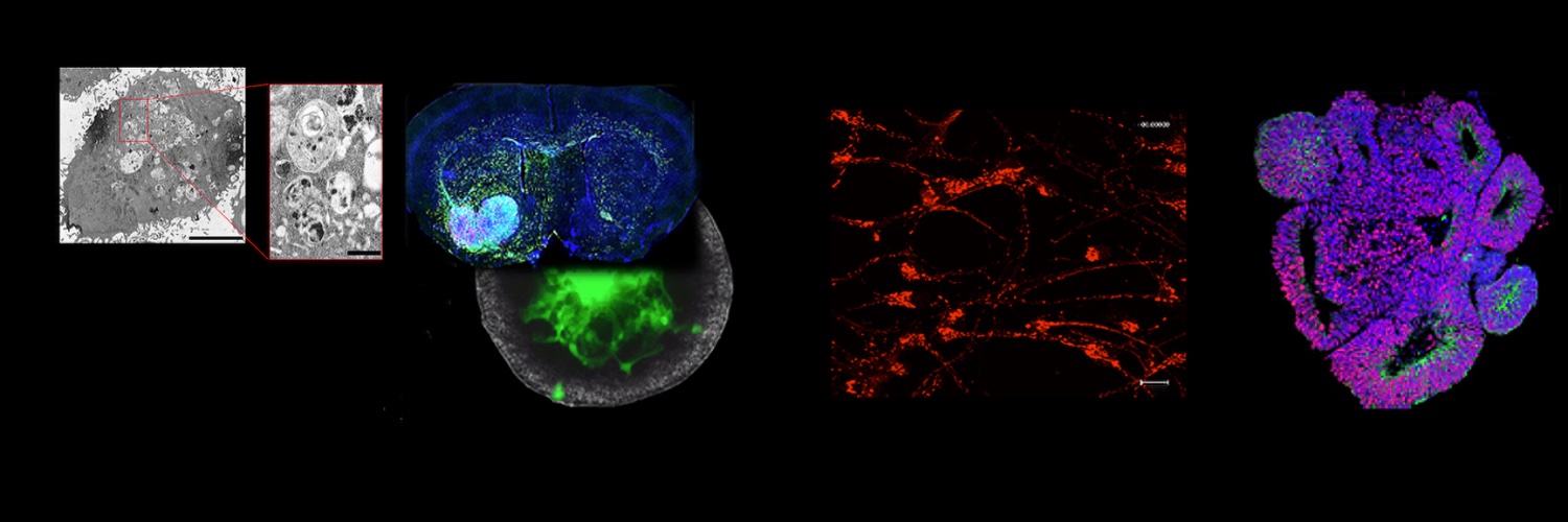Stem Cell and Brain Tumours Research Group banner