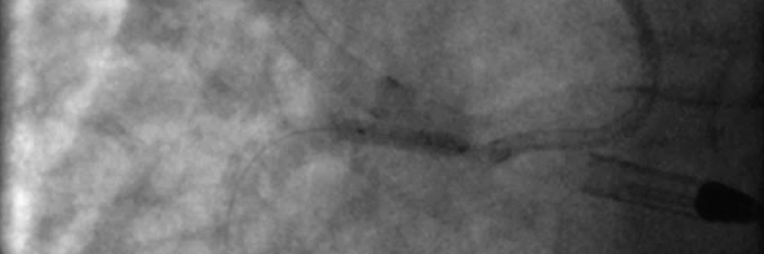 CHIP-BCIS3's banner
