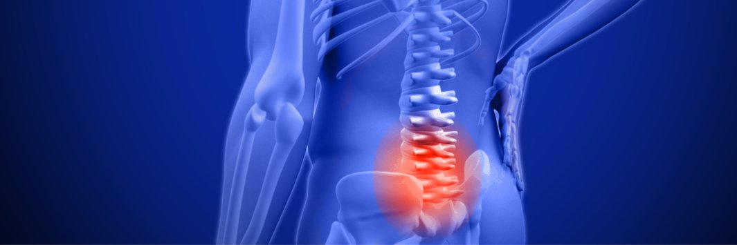 Cauda Equina Awareness banner