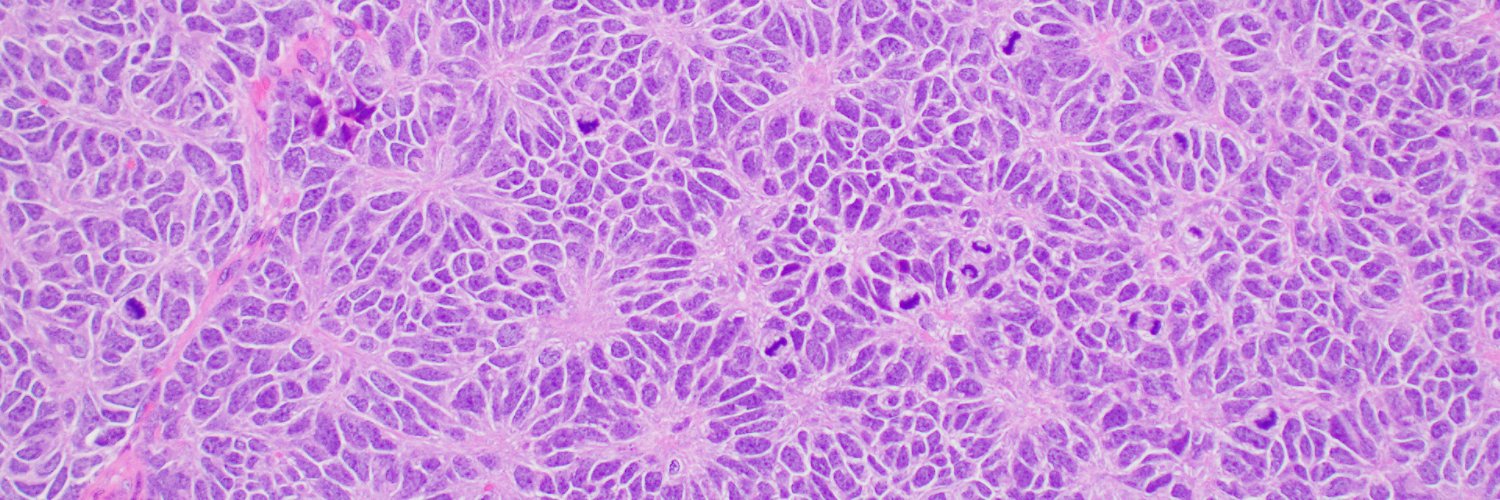 Pediatric Pathology at UT Southwestern banner