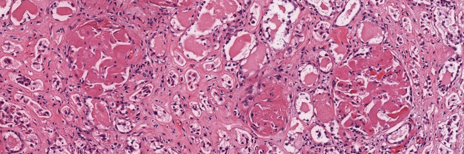 André Lametti banner