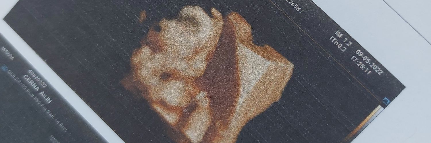 AilinCerna's profile banner image