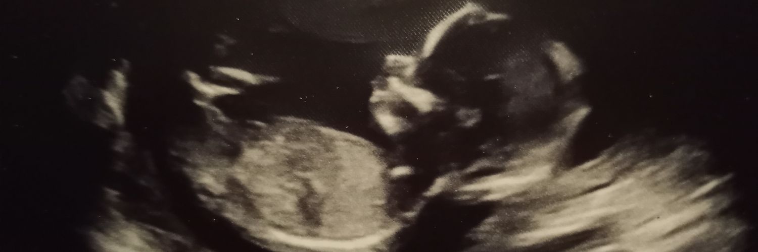 ezanders13's profile banner image