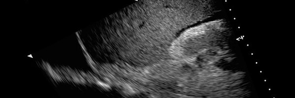 MetroHealth Emergency Ultrasound Profile Banner