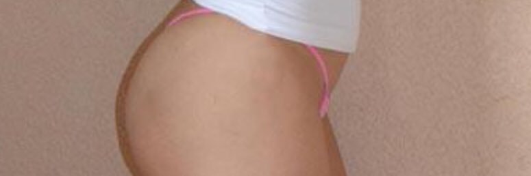 ALEXYNATA banner