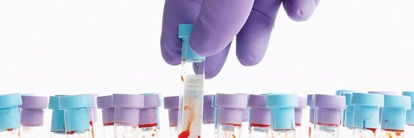 CureCancerNow Profile Banner