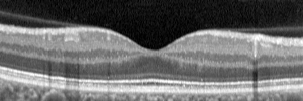 NeuroVisionLab Profile Banner