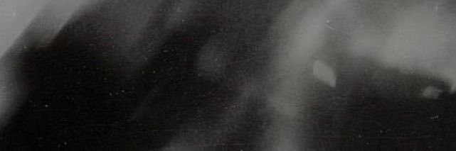 99… banner