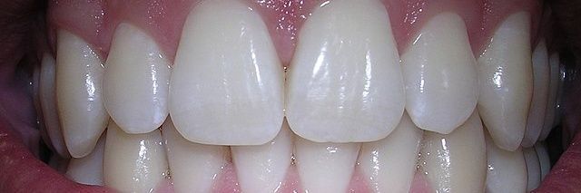 Tooth Man 375 banner