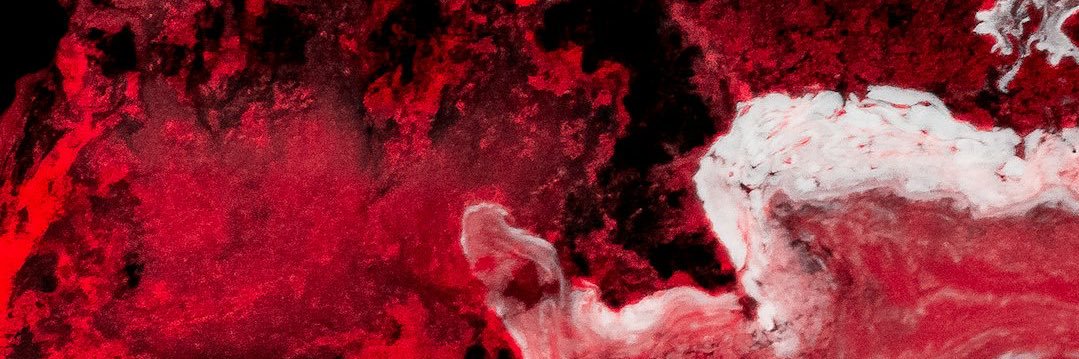 X banner