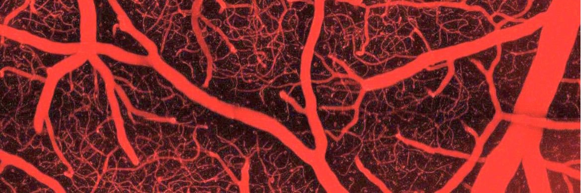 UVMHeartBrain's banner