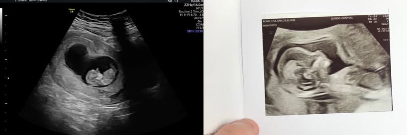 FertilityJourn2's profile banner image