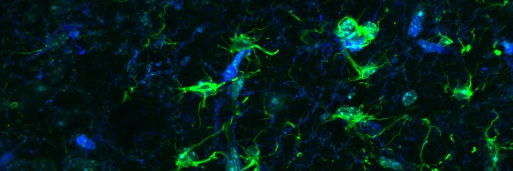 Fran Quintana Lab's banner