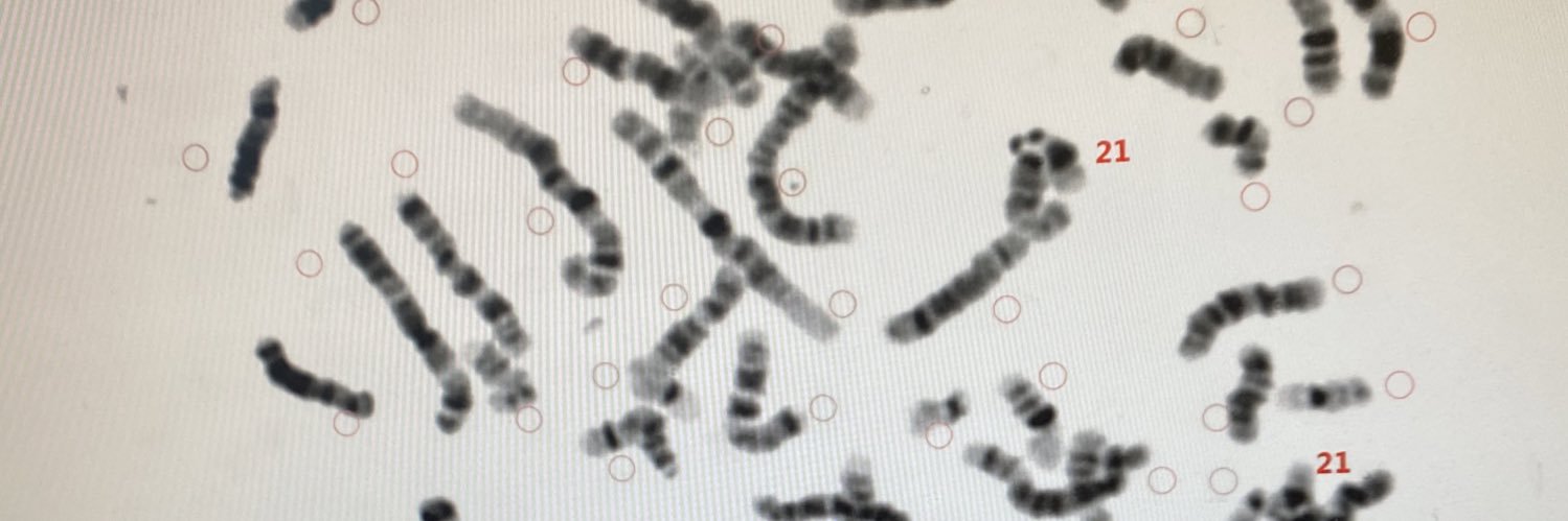 Liz Melchionna, MS, CGC, CG(ASCP) banner