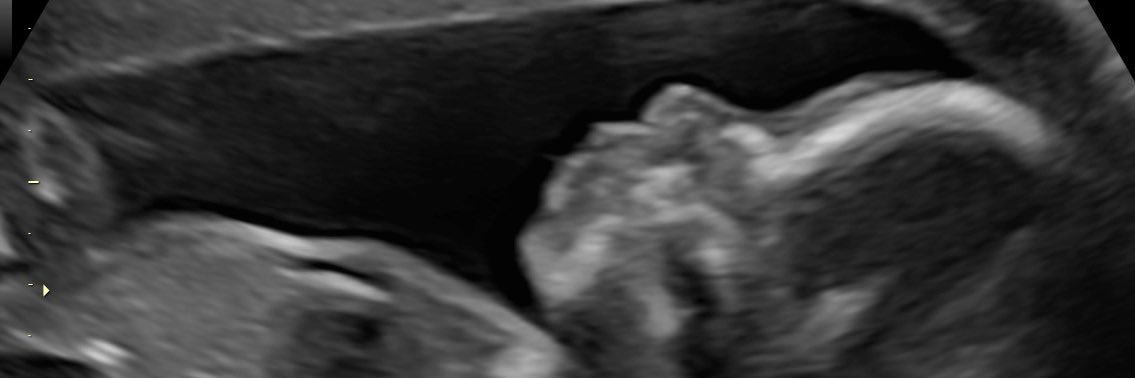 Valeriaramospr's profile banner image