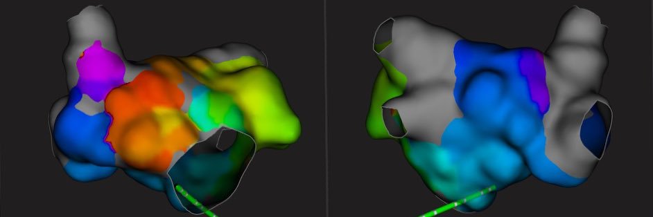 Alexander Karrip banner