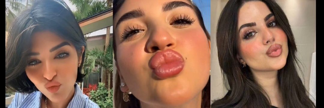 خنزير 🐽 banner