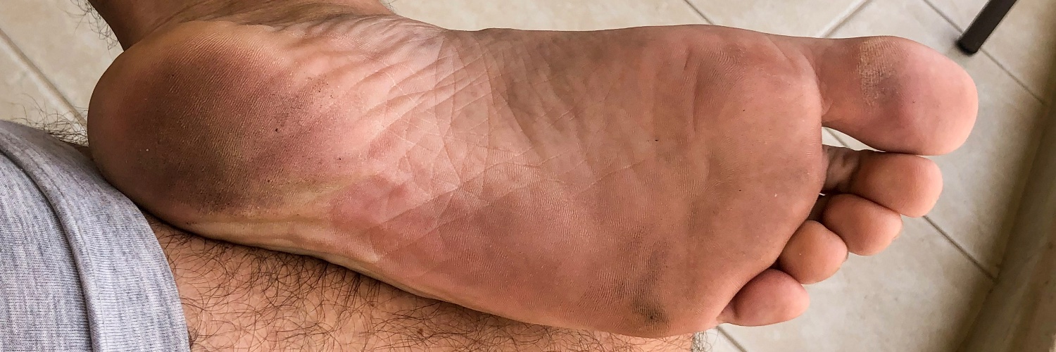 BrFeet banner