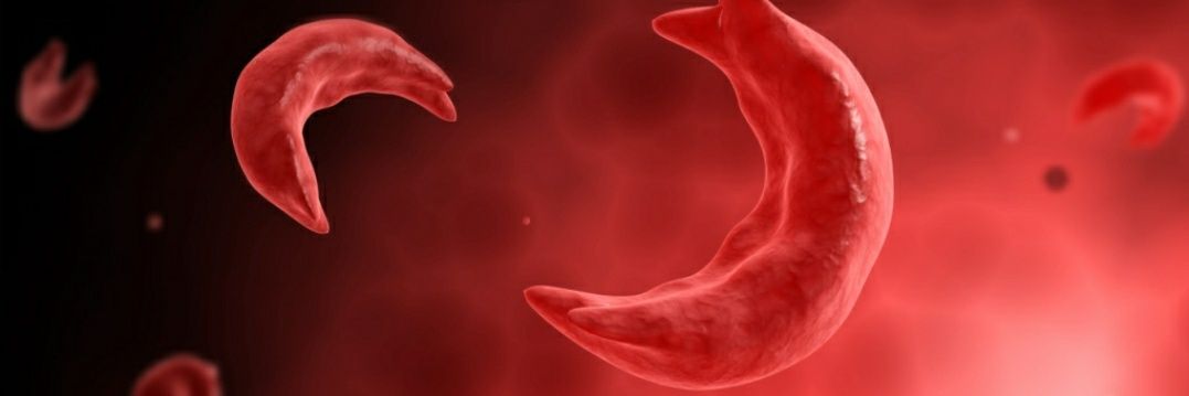 UEO Sickle Cell banner