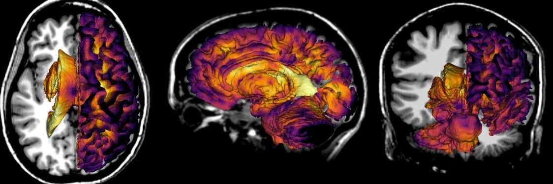 Candace Fleischer banner