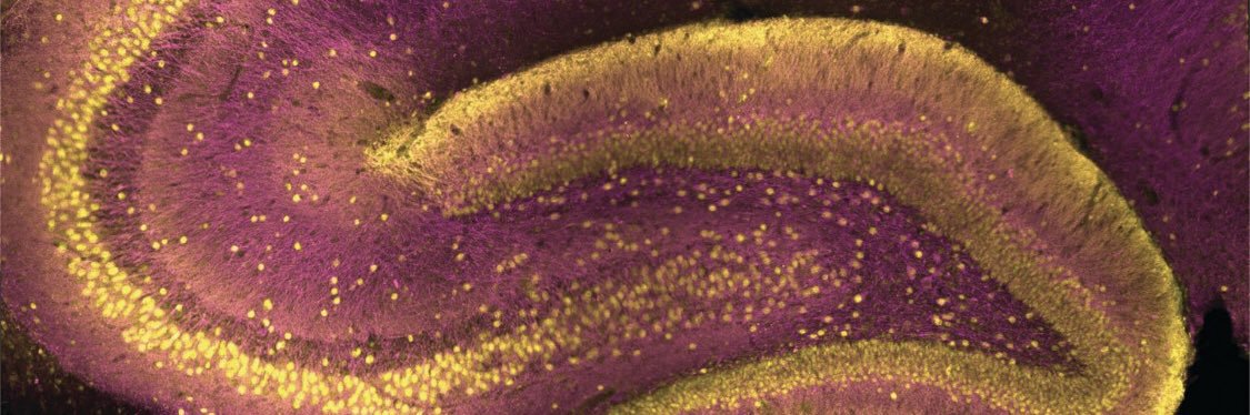 Bruce Herring banner