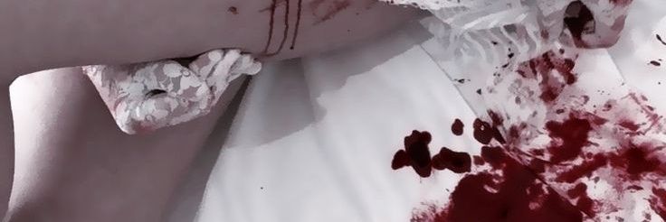 alyn banner