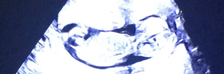diegolista's profile banner image