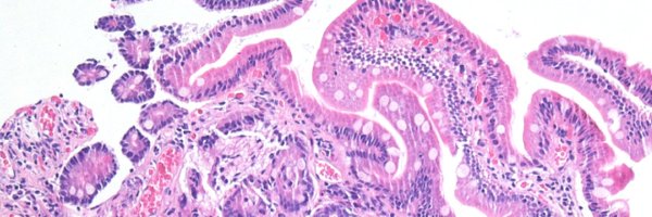 sfb1160 Profile Banner