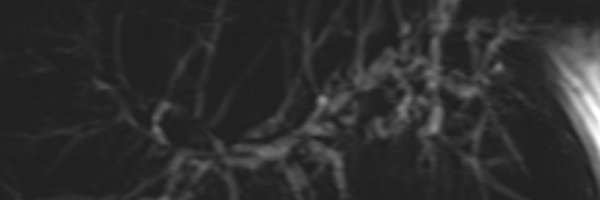 SARBiliaryDFP Profile Banner
