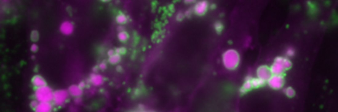 Lysosomes and Disease Lab banner