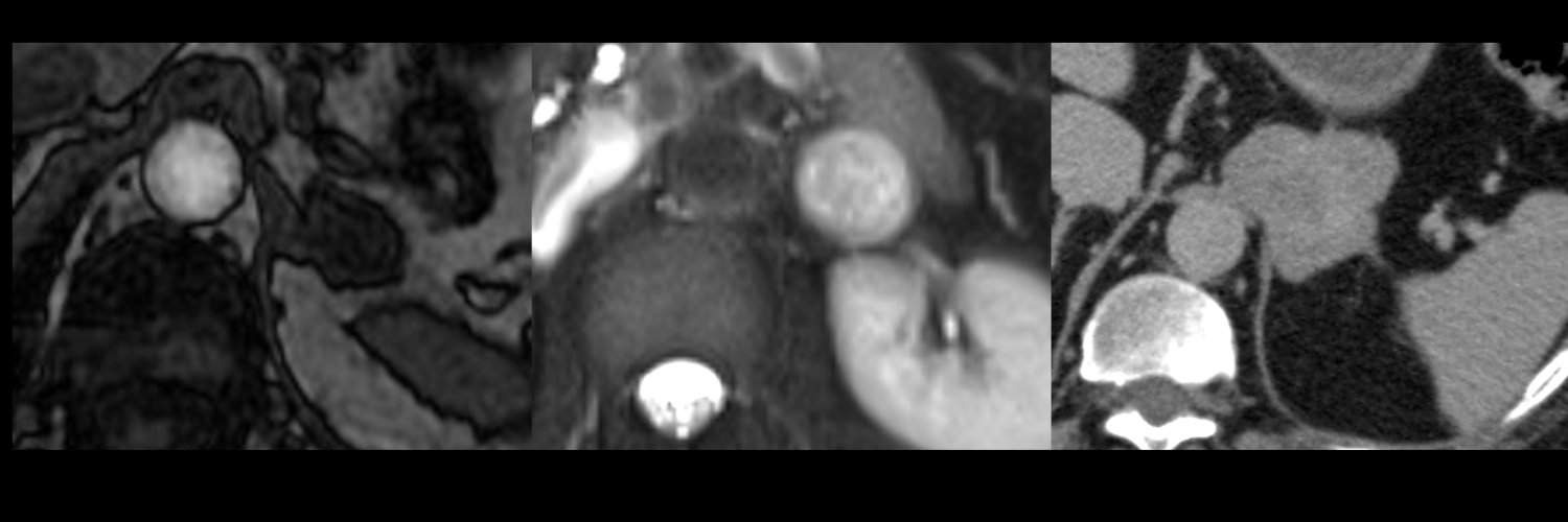 SAR_AdrenalDFP banner