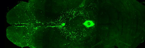 INFneuroendo Profile Banner
