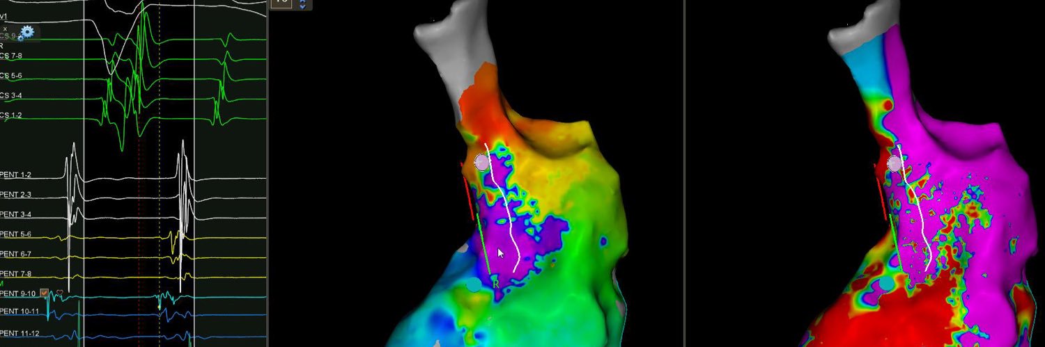 Wael Almutairi, CEPS banner
