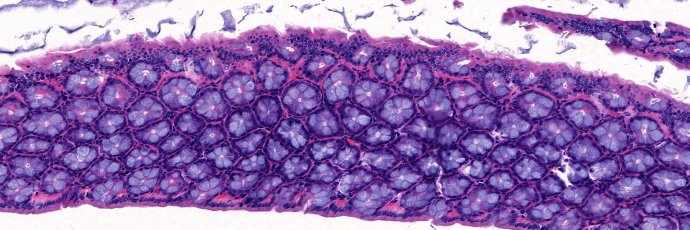 Mitro Miihkinen banner