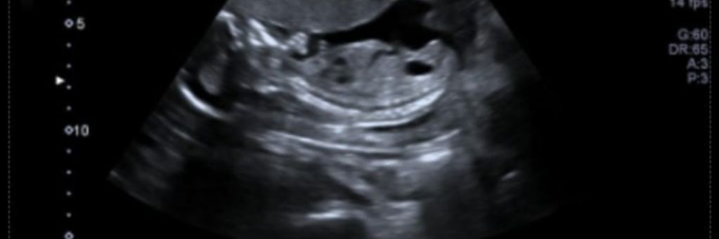 🤑NitSel🐱 banner