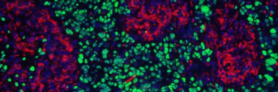 Kristensen Brain Cancer Group banner