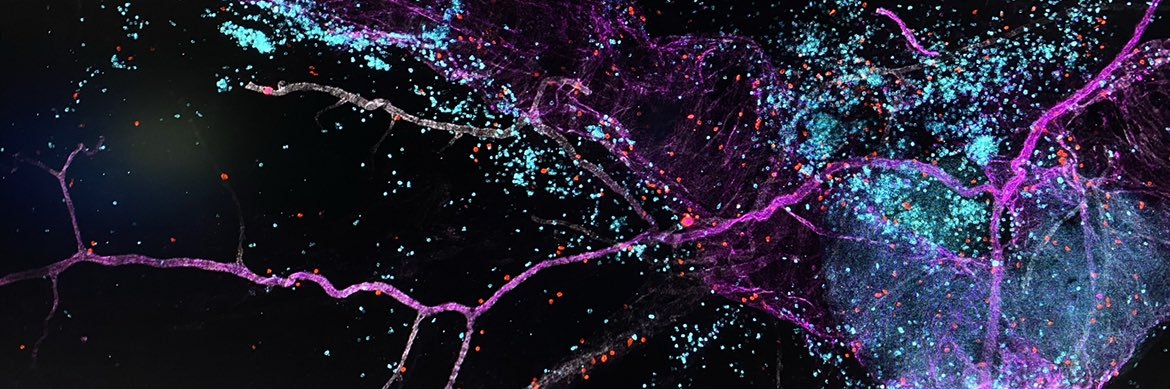 Theodore (Teddy) Fisher banner