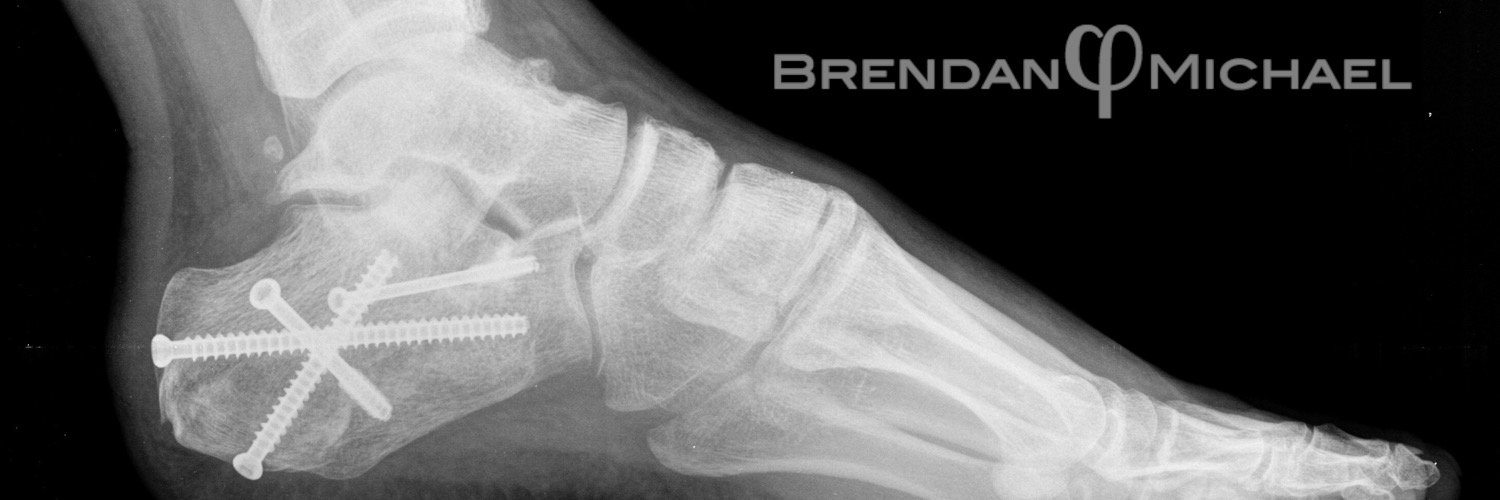 BrennyMikes's profile banner image
