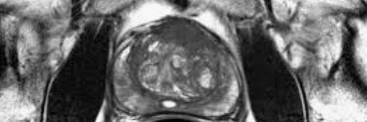 ProstateImage's profile banner image