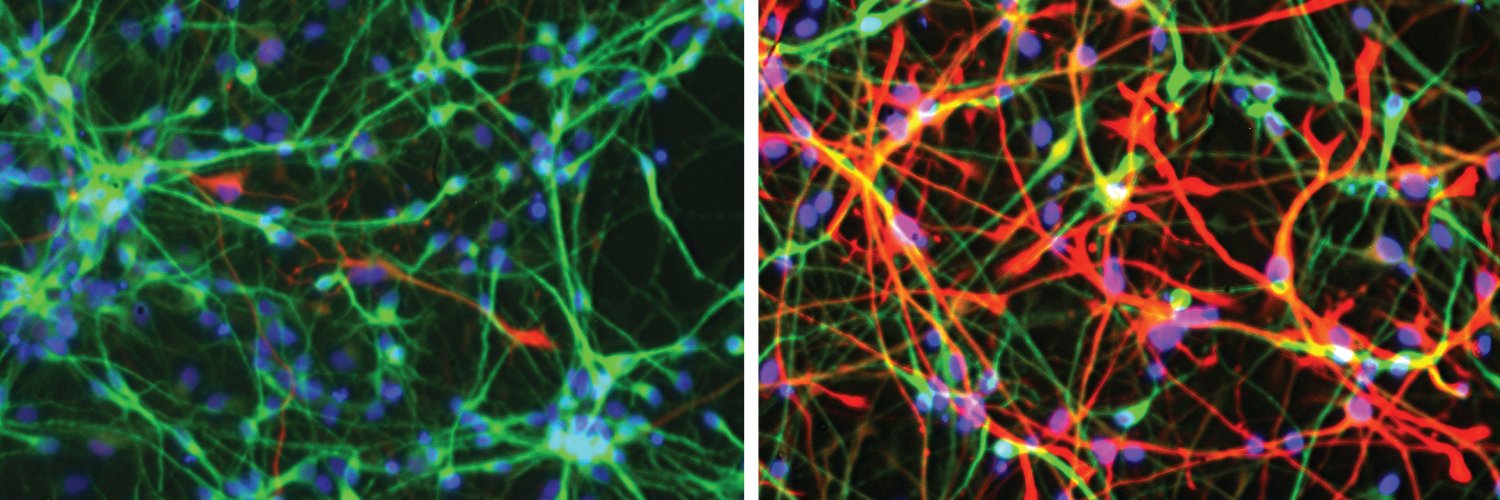 Neurometabolism banner