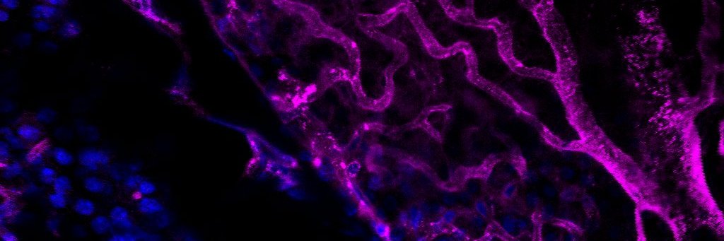 Jonathane Furon banner