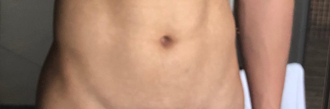 大黄-Ethuntis banner