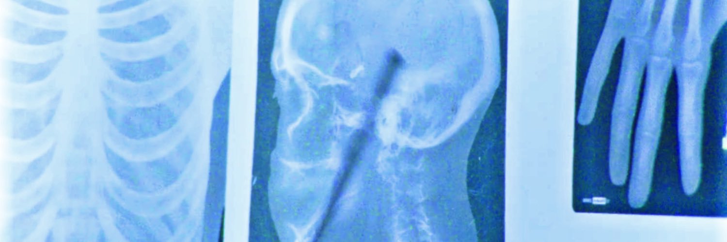 otto's banner
